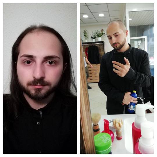 I had long and very thin hair. Decided to get a buzz cut. | Scrolller