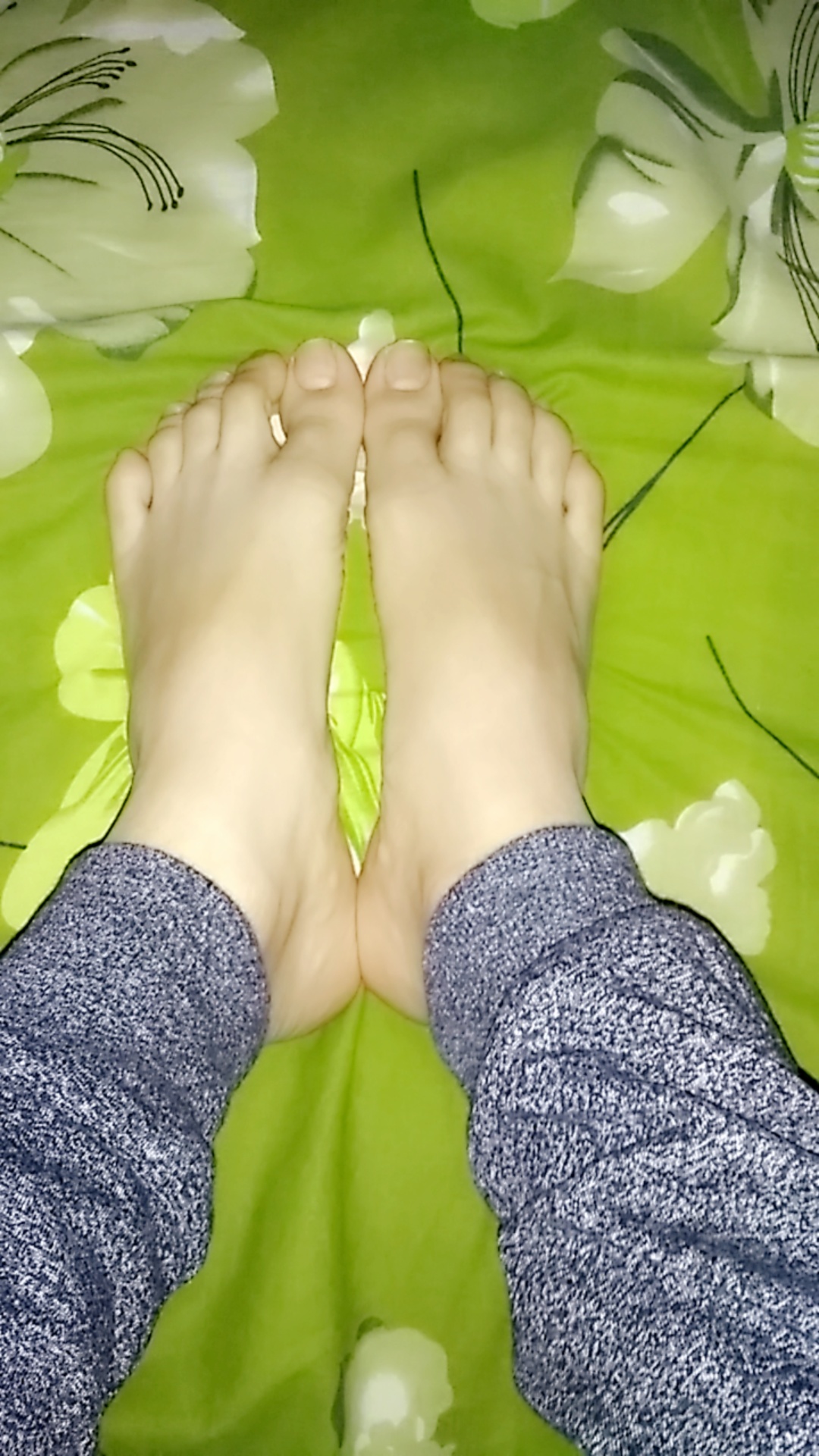 Tops of my feet. Sorry for no nail polish. Im allergic to the chemical :( |  Scrolller